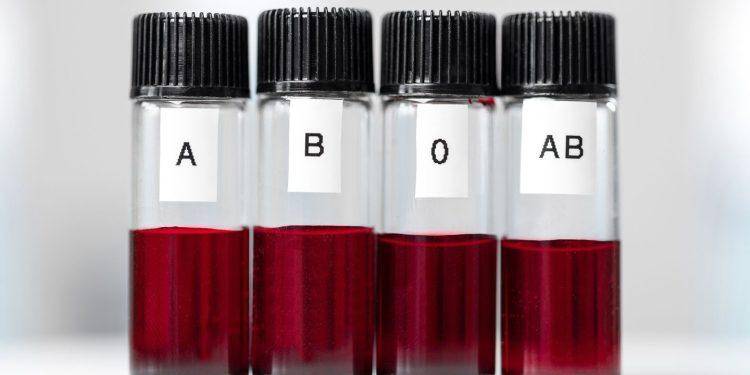 Görsel kaynağı: everydayhealth.com