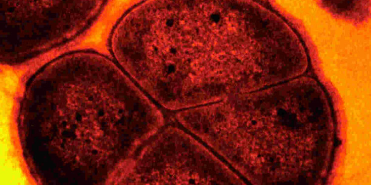 Deinococcus radiodurans. Görsel kaynağı: PLOS Biology