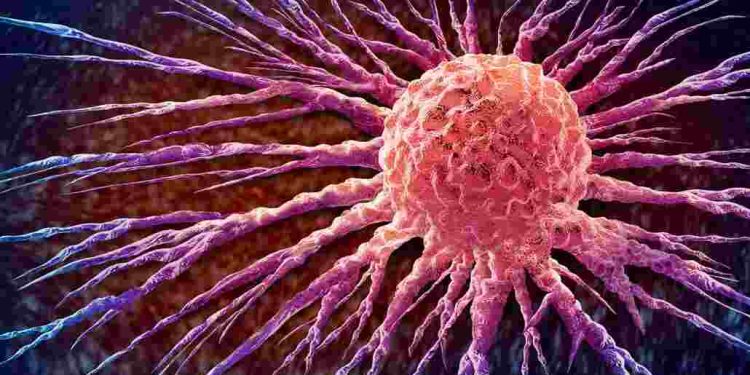 Meme Kanserinin Yayılması Kalıtsal OlabilirBasın Bildirisi 