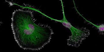 Ödüllü Görüntü, Alzheimer’ın Gizli Sebebini Ortaya ÇıkardıÇeviri 