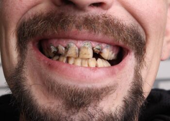 Yıkıcı Bir Bağımlılığın Anatomisi: MetamfetaminÖzgün 