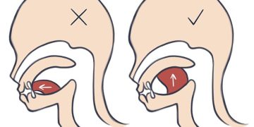 Mewing Nedir? Mewing Hareketi İşe Yarıyor mu?Özgün 